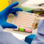 Nuovo studio prospettico interventistico IVIG/H/CoViD-19